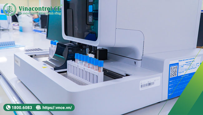 Máy xét nghiệm máu lắng nên được hiệu chuẩn, kiểm định ban đầu, định kỳ hàng năm